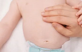 Yenidoğan kasık fıtığı neden olur? Bebeklerde kasık fıtığı belirtileri nelerdir?