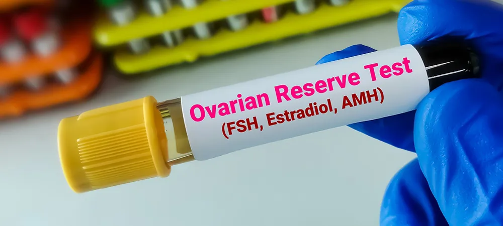Yumurtalık rezervi düşüklüğü (AMH) nedir? Yumurta rezervi düşükse ne yapılır? Yumurtalık rezervi düşüklüğü (AMH) nedir? Yumurta rezervi düşükse ne yapılır?